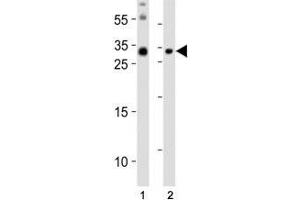 Western blot analysis of lysate from (1) mouse brain and (2) mouse skeletal muscle tissue lysate using Olig3 antibody at 1:1000. (OLIG3 Antikörper  (N-Term))