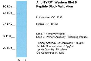 Host: Rabbit  Target Name: TYRP1  Sample Tissue: Human 721_BLane A:  Primary Antibody Lane B:  Primary Antibody + Blocking Peptide Primary Antibody Concentration: 1 µg/mL Peptide Concentration: 5. (Tyrosinase-Related Protein 1 Antikörper  (Middle Region))