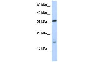 EIF1AX antibody used at 1 ug/ml to detect target protein. (EIF1AX Antikörper  (Middle Region))