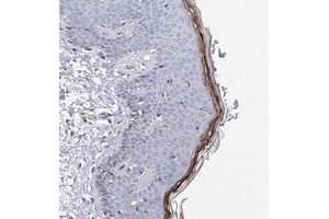 Immunohistochemical staining of human skin with HRNR polyclonal antibody  shows distinct positivity in granular layer cells. (HRNR Antikörper)