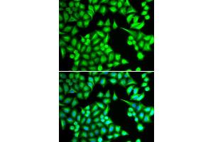 Immunofluorescence analysis of HeLa cell using IL21 antibody. (IL-21 Antikörper)