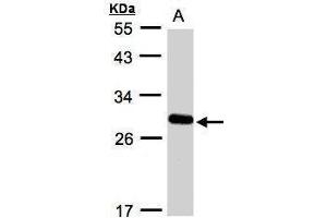 Western blot analysis of 30 ug whole cell lysate (A:A431) using a 12 % SDS PAGE gel and YIPF4 antibody at a dilution of 1:1000