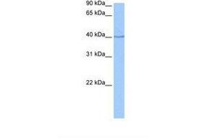 Image no. 1 for anti-Sp6 Transcription Factor (SP6) (C-Term) antibody (ABIN6739473)