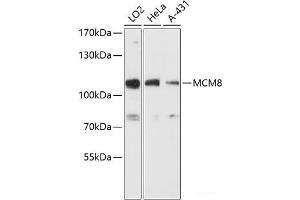 Western blot analysis of extracts of various cell lines using MCM8 Polyclonal Antibody at dilution of 1:3000. (MCM8 Antikörper)