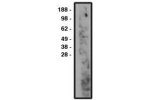 Image no. 1 for anti-Sphingomyelin Phosphodiesterase 3 (SMPD3) antibody (ABIN793721) (SMPD3 Antikörper)