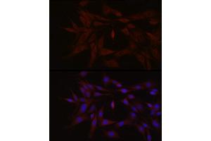 Immunofluorescence (IF) image for anti-Tyrosine Kinase 2 (TYK2) (AA 750-850) antibody (ABIN3022988)