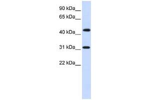 Human Brain; WB Suggested Anti-ZNF684 Antibody Titration: 0. (ZNF684 Antikörper  (N-Term))