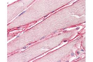 Anti-SGCD / Delta-Sarcoglycan antibody IHC of human skeletal muscle. (SGCD Antikörper  (AA 244-256))