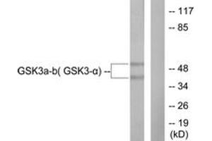Western blot analysis of extracts from 293 cells, treated with TNF-a 20ng/ml 30', using GSK3 alpha/beta (Ab-279/216) Antibody. (GSK3 alpha/beta Antikörper  (AA 246-295))