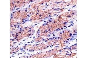 Immunohistochemical analysis of paraffin-embedded human stomach using PHB1 antibody at 1:25 dilution. (Prohibitin Antikörper)