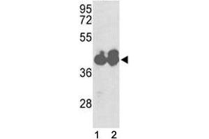 Western blot analysis of IDH1 antibody and HepG2 cell line and mouse liver tissue lysate. (IDH1 Antikörper  (AA 116-143))