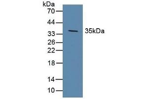 Detection of DKK1 in Porcine Brain Tissue using Polyclonal Antibody to Dickkopf Related Protein 1 (DKK1) (DKK1 Antikörper  (AA 33-266))