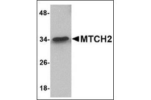 Western blot analysis of MTCH2 in 293 cell lysate with this product at 1 μg/ml. (MTCH2 Antikörper  (N-Term))