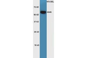 Lane 1: A549 cell lysates probed with Rabbit Anti-OCT2 Polyclonal Antibody, Unconjugated  at 1:5000 for 90 min at 37˚C. (Oct-2 Antikörper  (AA 11-100))
