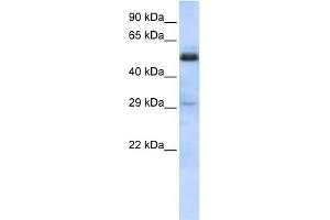 WB Suggested Anti-SCML1 Antibody Titration:  0. (SCML1 Antikörper  (Middle Region))
