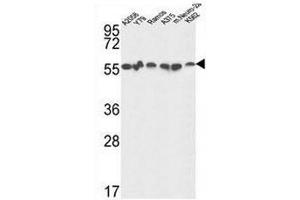 GPI Antibody (C-term) western blot analysis in A2058,Y79,Ramos,A375,K562 and mouse Neuro-2a cell line lysates (35µg/lane).