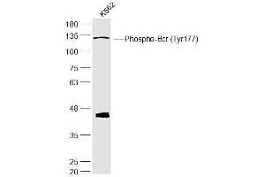 K562 lysates probed with Phospho-Bcr (Tyr177) Polyclonal Antibody, Unconjugated  at 1:300 dilution and 4˚C overnight incubation. (BCR Antikörper  (pTyr177))