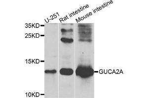Western blot analysis of extracts of various cell lines, using GUCA2A antibody. (GUCA2A Antikörper)