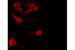ABIN6275452 staining  HeLa cells by IF/ICC.