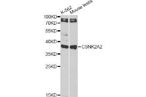Western blot analysis of extracts of various cell lines, using CSNK2A2 antibody (ABIN6290214) at 1:1000 dilution. (CSNK2A2 Antikörper)