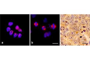 Immunocytochemistry of TPX2 using monoclonal antibody TPX2-01 in glioblastoma cell line T98G: a) interphase, b) mitosis. (TPX2 Antikörper)