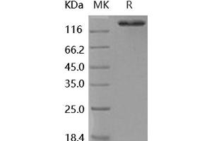 Western Blotting (WB) image for Angiotensin I Converting Enzyme 2 (ACE2) (Active) protein (Fc Tag) (ABIN7317135)