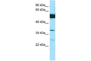 WB Suggested Anti-LGSN Antibody Titration: 1. (LGSN Antikörper  (N-Term))