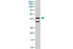 LHX6 monoclonal antibody (M05), clone 3E8. (LHX6 Antikörper  (AA 274-363))