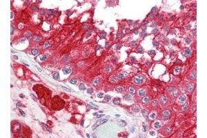 Human Testis (formalin-fixed, paraffin-embedded) stained with ACE2at 2. (ACE2 Antikörper  (N-Term))