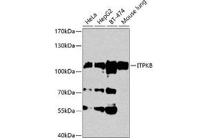 Western blot analysis of extracts of various cell lines, using ITPKB antibody (ABIN1680537, ABIN3018302, ABIN3018303 and ABIN6220431) at 1:1000 dilution. (ITPKB Antikörper  (AA 1-260))