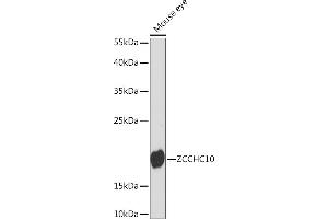 Western blot analysis of extracts of Mouse eye, using ZCCHC10 Rabbit pAb (ABIN7271545) at 1:1000 dilution. (ZCCHC10 Antikörper  (AA 1-100))