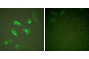 PMA + -Immunofluorescence analysis of HeLa cells, treated with PMA (125ng/ml, 30mins), using 14-3-3 ζ (Ab-58) antibody (#B0001). (14-3-3 zeta Antikörper  (Ser58))