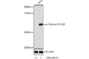 Western blot analysis of extracts of HeLa cells using Phospho-Histone H3(S10) Polyclonal Antibody at dilution of 1:1000. (Histone 3 Antikörper  (pSer10))