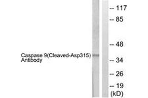 Western blot analysis of extracts from 293 cells, treated with Etoposide 25uM 60', using Caspase 9 (Cleaved-Asp315) Antibody. (Caspase 9 Antikörper  (Cleaved-Asp315))