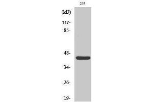 Western Blotting (WB) image for anti-RAD52 Homolog (S. Cerevisiae) (RAD52) (Thr56) antibody (ABIN3186662)