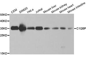 Western blot analysis of extracts of various cell lines, using C1QBP antibody. (C1QBP Antikörper)