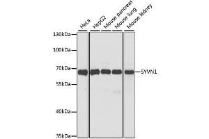 Western blot analysis of extracts of various cell lines, using SYVN1 antibody (ABIN1875011) at 1:1000 dilution. (SYVN1 Antikörper)