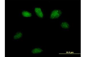 Immunofluorescence of purified MaxPab antibody to GSTO2 on HeLa cell. (GSTO2 Antikörper  (AA 1-243))