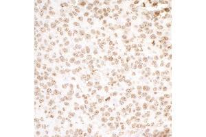 Immunohistochemistry (IHC) image for anti-H2A Histone Family, Member X (H2AFX) (C-Term) antibody (ABIN7453533)