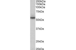 Western Blotting (WB) image for anti-MARE (C16orf35) antibody (ABIN5944454) (Mare/Nprl3/C16orf35 Antikörper)