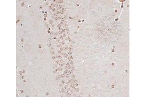 Immunohistochemistry of paraffin-embedded Mouse brain using ZNF177 Polyclonal Antibody at dilution of 1:100 (40x lens). (ZNF177 Antikörper)