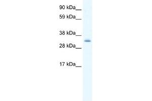 Western Blot showing PDLIM1 antibody used at a concentration of 1-2 ug/ml to detect its target protein. (PDLIM1 Antikörper  (Middle Region))