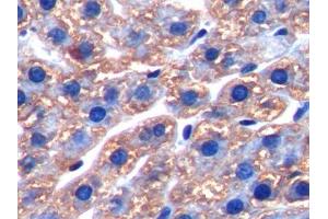 IHC-P analysis of Rat Liver Tissue, with DAB staining. (FTH1 Antikörper  (AA 1-182))