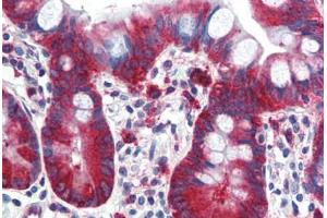 Human Small Intestine (formalin-fixed, paraffin-embedded) stained with TPD52L1 antibody ABIN364314 at 5 ug/ml followed by biotinylated anti-mouse IgG secondary antibody ABIN481714, alkaline phosphatase-streptavidin and chromogen. (TPD52L1 Antikörper)