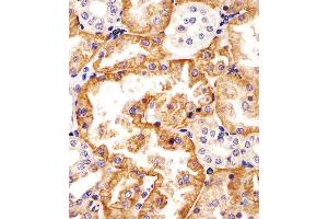 (ABIN6242877 and ABIN6578324) staining SLC22A2 in human kidney tissue sections by Immunohistochemistry (IHC-P - paraformaldehyde-fixed, paraffin-embedded sections). (SLC22A2 Antikörper  (N-Term))