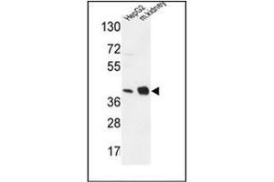 Western blot analysis of NDUFA10 Antibody (Center) in HepG2 cell line and mouse kidney tissue lysates (35ug/lane). (NDUFA10 Antikörper  (Middle Region))