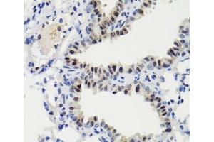 Immunohistochemistry of paraffin-embedded Mouse lung using Phospho-Stat3(S727) Polyclonal Antibody at dilution of 1:100 (40x lens). (STAT3 Antikörper  (pSer727))