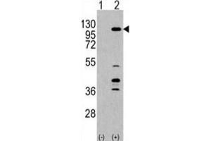 Western Blotting (WB) image for anti-Phosphoinositide-3-Kinase, Catalytic, gamma Polypeptide (PIK3CG) antibody (ABIN3003740)