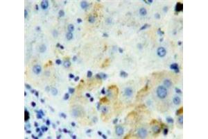 Used in DAB staining on fromalin fixed paraffin-embedded Liver tissue (FURIN Antikörper  (AA 587-748))