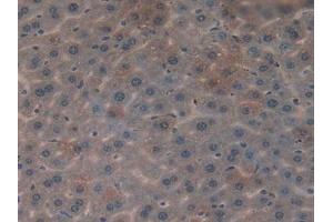 Figure. (CYR61 Antikörper  (AA 176-379))